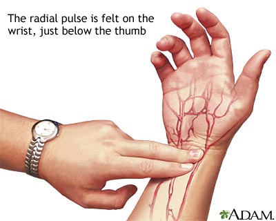 Pulso radial