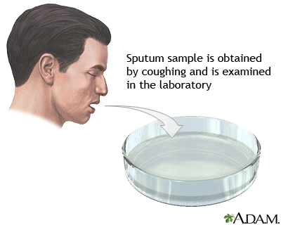 Image result for sputum sample