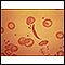 Red blood cells, sickle cell
