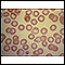 Malaria - microscopic view of cellular parasites