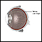 Retinal detachment repair - normal anatomy