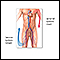 Venous thrombosis - series - Normal anatomy