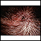 Ringworm, tinea capitis - close-up