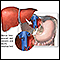 Donor liver attachment