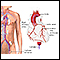 Cardiac arteriogram
