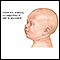 Infant test/procedure preparation
