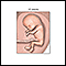 Fetus at 10 weeks