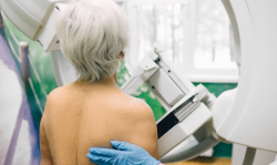 A woman with gray hair screened for breast cancer by mammogram