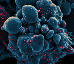 Colorized scanning electron micrograph of an apoptotic cell (blue) infected with SARS-COV-2 virus particles (red), isolated from a patient sample. Image captured at the NIAID Integrated Research Facility (IRF) in Fort Detrick, Maryland. Credit: NIAID