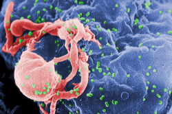 Immature HIV (in green) budding from an immune cell in an electron microscope image. This process ultimately ends with a mature virus that can infect other cells. (Photo by Centers for Disease Control and Prevention.)