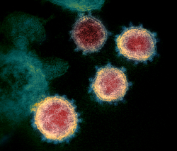 An image of the coronavirus as seen using an electron microscope. The virus' distinctive spikes are easily visible. (Photo by NIAID-RML)