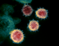 Electronic microscope image of the novel coronavirus isolated from a patient. The virus is shown emerging from the surface of cells cultured in the laboratory. (Photo by National Institute of Allergy and Infectious Diseases – Rocky Mountain Laboratories)