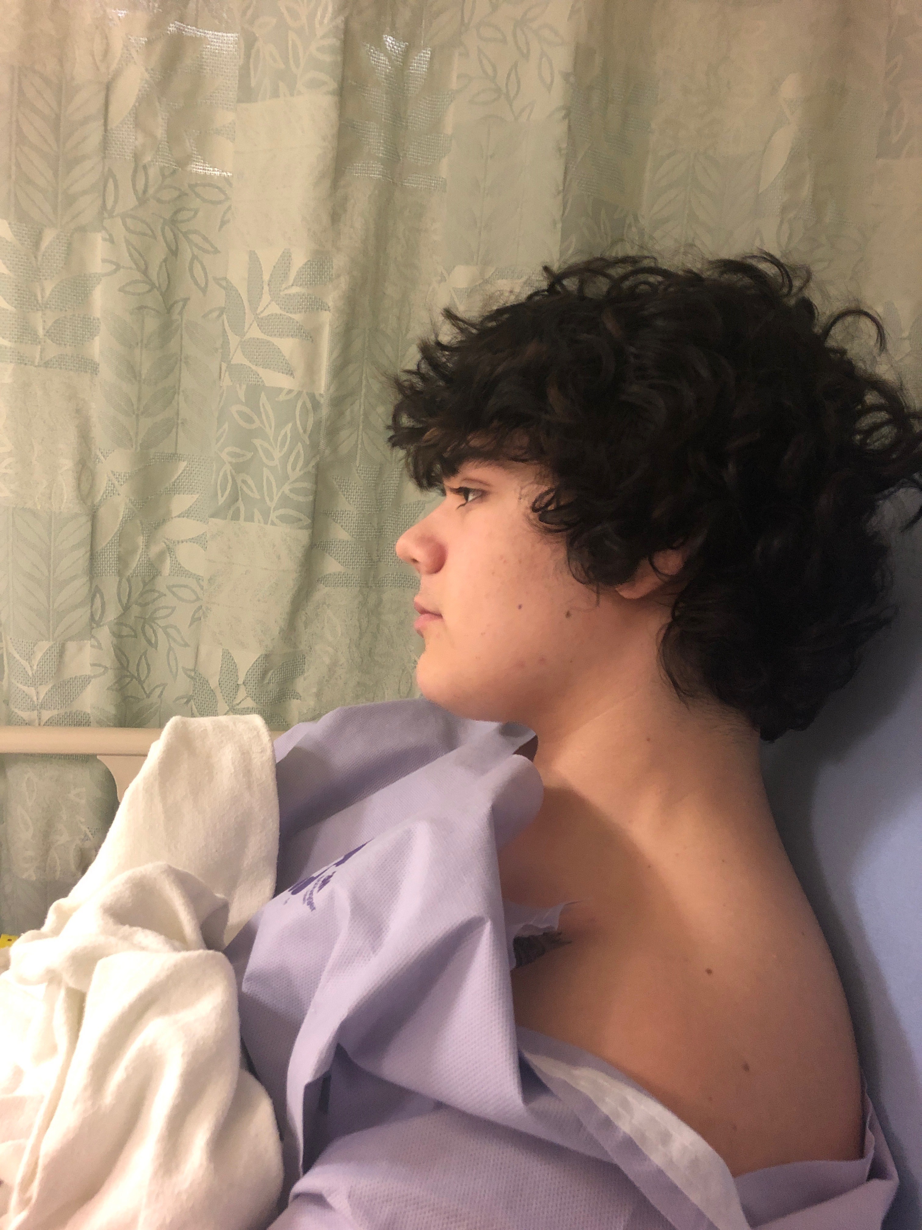 profile view of a teen boy in a hospital gown in a hospital bed