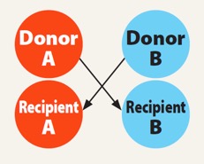 In a two-pair exchange, two donors donate a kidney to one another.