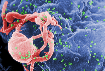 An electron microscope image of immature HIV budding from an immune cell. This image was provided by the Centers for Disease Control and Prevention.